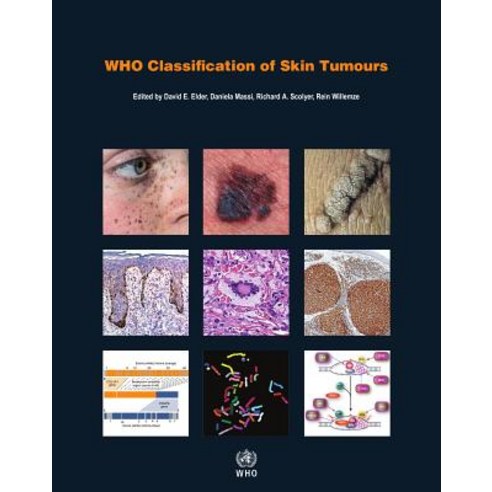 Who Classification of Skin Tumours, World Health Organization
