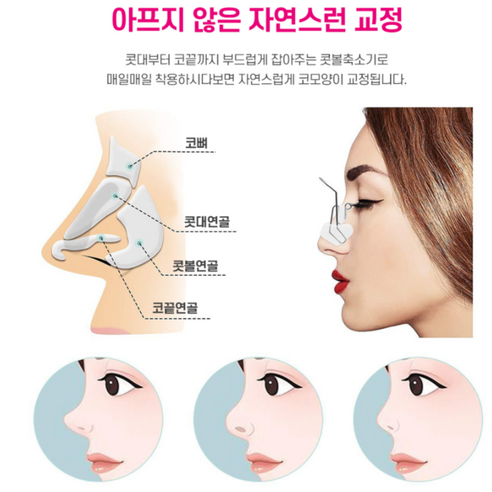아름다운 콧날을 위한 섬세한 선택, 미소다믄 노즈업 교정기