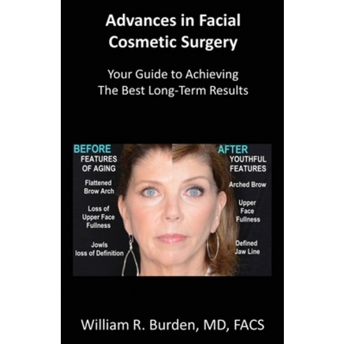 Advances in Facial Cosmetic Surgery: Your Guide to Achieving the Best Long-Term Results Paperback, William Burden, English, 9780578715599