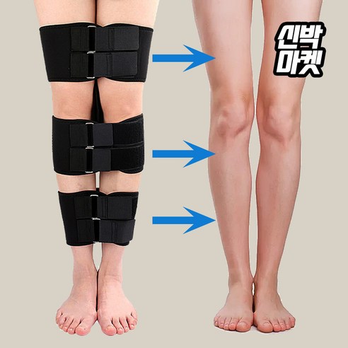 O자 다리, 숨기지 말고 당당하게! 신박마켓 오자다리 교정밴드 솔직 후기 오자다리교정기