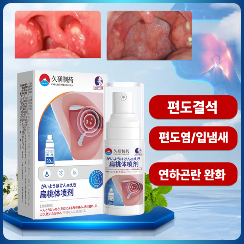 상쾌한 숨결, 건강한 구강을 위한 섬세한 선택: 편도결석 제거 구강 스프레이 편도결석제거