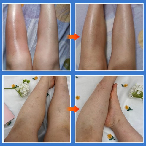 욱신거리는 몸, 붙이고 편하게 쉬세요!