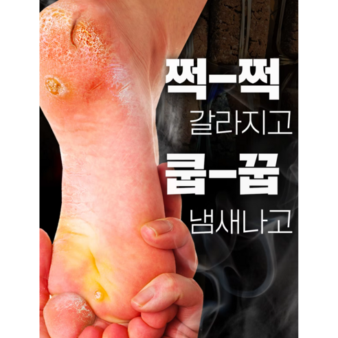 올인원 발 관리 스프레이로 문제성 발 고민, 이제 안녕!
