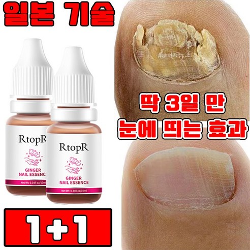발톱 무좀약 치료제