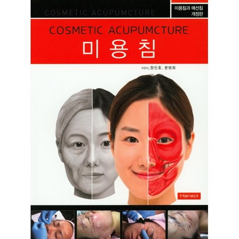 미용침 : 미용침과 매선침 개정판 (Cosmetic Acupuncture)