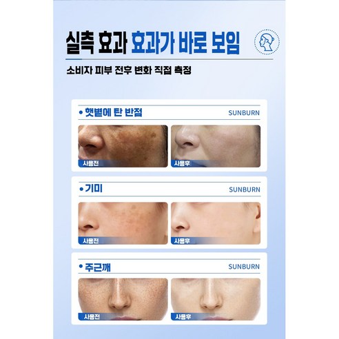 붙이는 기미 패치로 간편하게 맑은 피부 되찾기!