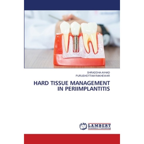 (영문도서) Hard Tissue Management in Periimplantitis Paperback, LAP Lambert Academic Publis..., English, 9786203201642