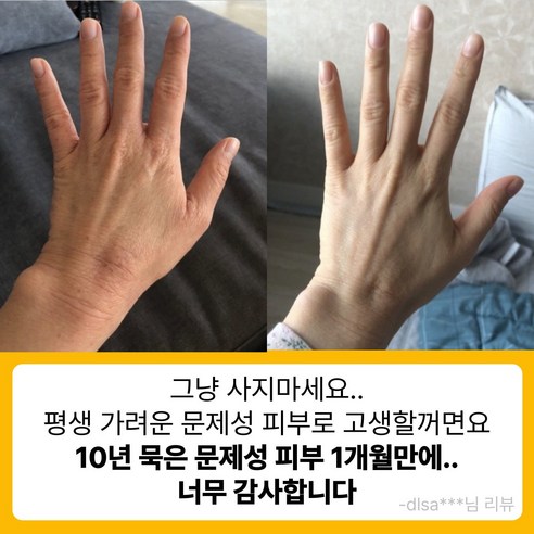 자연의 힘으로 민감한 피부를 다독이는 꿀토피 플라보노이드 수제 비누