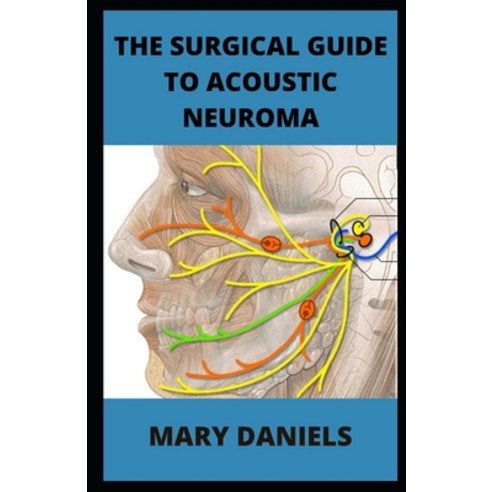 (영문도서) The Surgical Guide to Acoustic Neuroma: Discover How To Avoid Acoustic Neuroma Paperback, Independently Published, English, 9798352219423