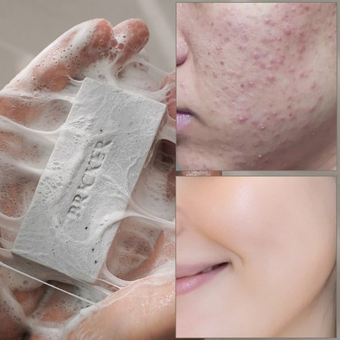 브릭커 머디 어성초 CP 천연비누 140g (머드팩 고체팩), 1개입