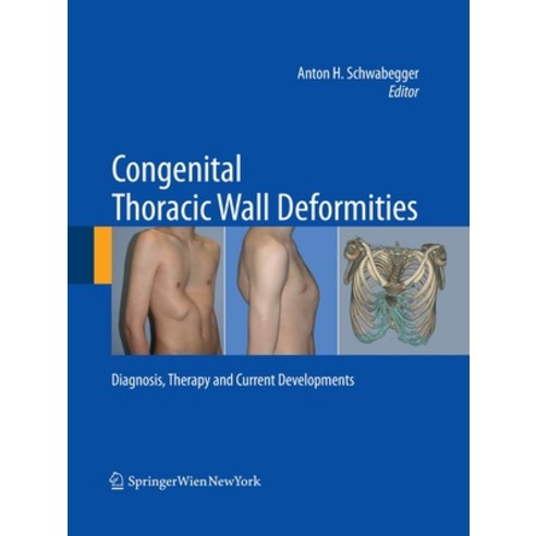 (영문도서) Congenital Thoracic Wall Deformities: Diagnosis Therapy and Current Developments Paperback, Springer, English, 9783709119105