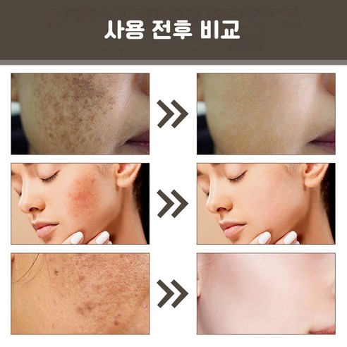 3일의 기적, 맑고 투명한 피부를 되찾다