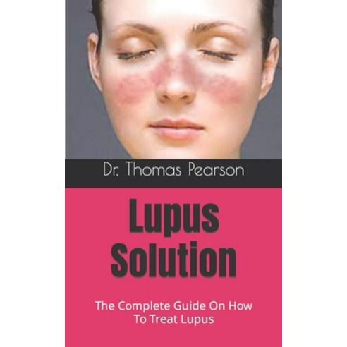 (영문도서) Lupus Solution: The Complete Guide On How To Treat Lupus Paperback, Independently Published, English, 9798490592013