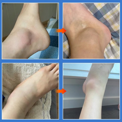 욱신거리는 몸, 붙이고 편하게 쉬세요!