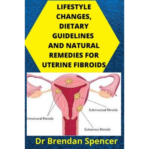 Lifestyle Changes Dietary Guidelines and Natural Remedies for Uterine Fibroids Paperback, Independently Published, English, 9798571868938