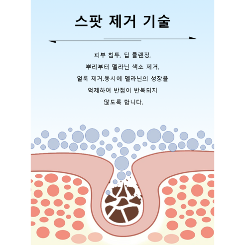 반점 없는 빛나는 얼굴을 위한 궁극의 솔루션