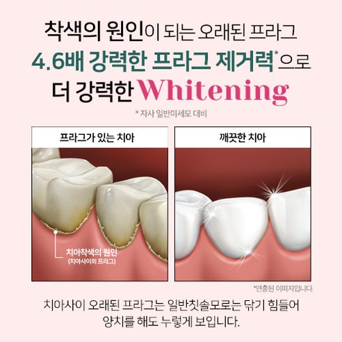 착색물질 제거로 더 밝고 더 하얀 미소