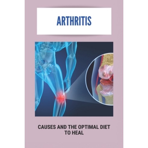 Arthritis: Causes And The Optimal Diet To Heal: What Vegetables Are Bad For Arthritis Paperback, Independently Published, English, 9798731413657