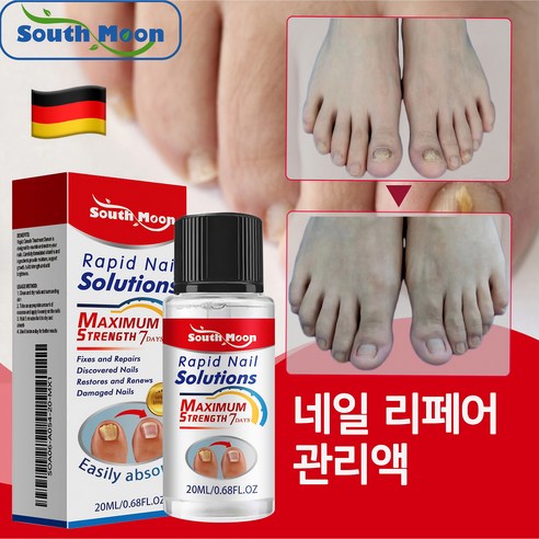 [독일에서 수입]South moon조갑진균증 진균제 독일의 최신 기술 효과적인 치료 보장 손톱 곰팡이 손발톱 진균증 두꺼워진 손톱 손발톱바닥 분리 등의 증상 안전하고 자극적이지 않, 2개, 20ml