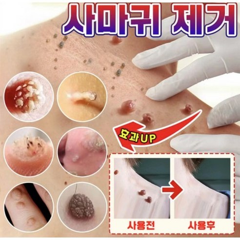 피부 고민, 한방 제조로 해결하세요