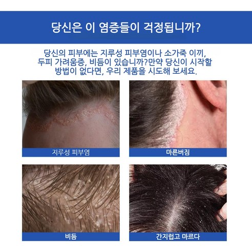 KORE LAN 지루성 두피염 탈모 머리 여드름이 가렵다 두피진균 여드름 케어 피부 연고