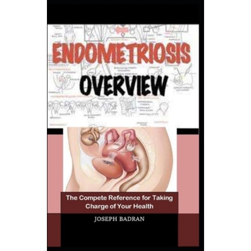 (영문도서) Endometriosis Overview: The Compete Reference for Taking Charge of Your Health Paperback, Independently Published, English, 9798530497278