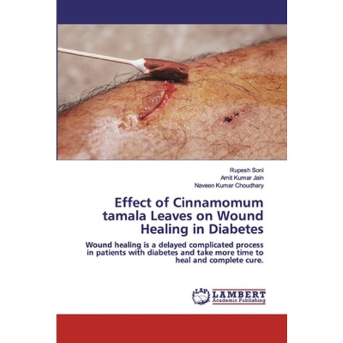 Effect of Cinnamomum tamala Leaves on Wound Healing in Diabetes Paperback, LAP Lambert Academic Publishing