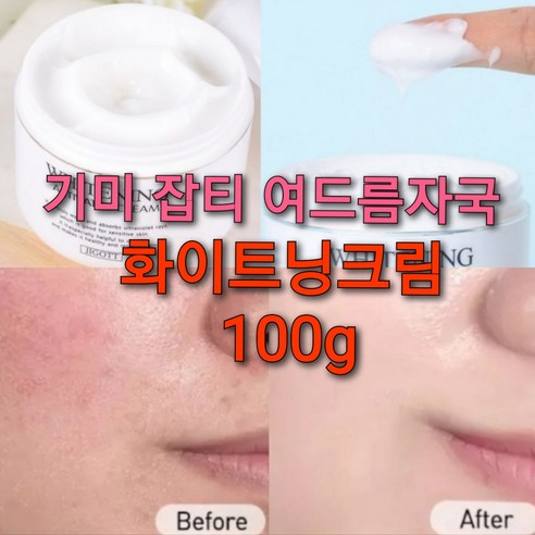 기미 검버섯 화이트닝크림 100g/멜라닌 크림, 1+1개, 1개, 100g