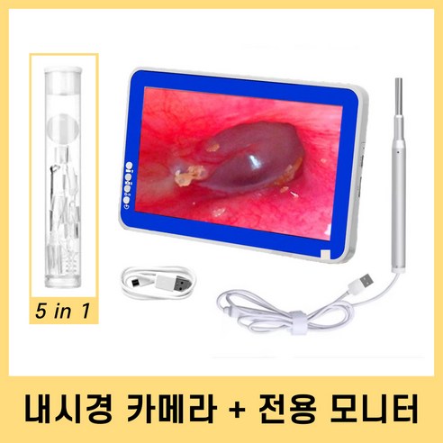 코지로움 귀 내시경 카메라 모니터 귀이개 귀지제거, 화이트 7인치 모니터, 1개, 1개입