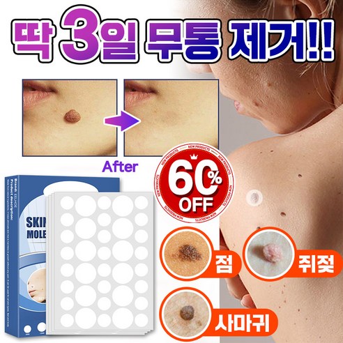 [빠른배송] 피부 제거 패치 얼굴 바디 피부 치료 라벨 스텔스, 2개