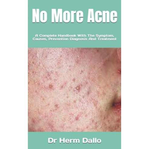 (영문도서) No More Acne: A Complete Handbook With The Symptom Causes Prevention Diagnosis And Treatment Paperback, Independently Published, English, 9798360437321