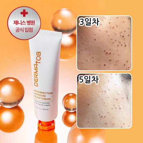 [Jenith병원 입점] 피부과 직원 입소문 더마토브 EGF 레이저 회복 재생 진정 시카 여름 수분크림, 1개, 100ml