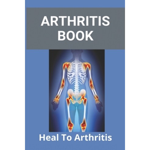 Arthritis Book: Heal To Arthritis: Rheumatoid Arthritis Treatment Paperback, Independently Published, English, 9798733975245