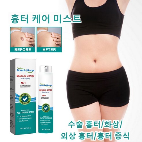 흉터 케어 미스트: 흉터를 눈에 띄지 않게 하는 비밀 무기