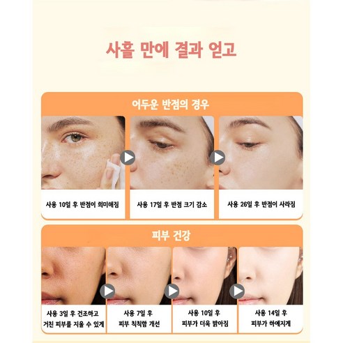 벚꽃처럼 화사하게, 일본 기미 잡티 제거 크림으로 빛나는 피부를 되찾으세요!