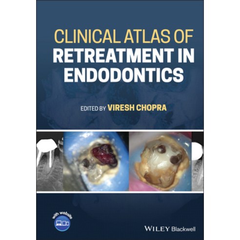 (영문도서) Clinical Atlas of Retreatment in Endodontics Hardcover, Wiley-Blackwell, English, 9781119509202