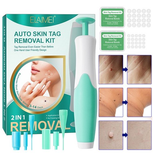 [빠른배송] 2in1 제거 치료 피부 태그 제거 도구 없애는법 얼굴 피부케어 포장증정, 그린, 1개, 그린