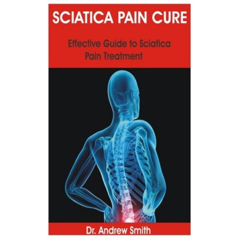 Sciatica Pain Cure: Effective Guide to Sciatica Pain Treatment Paperback, Independently Published, English, 9798730748309