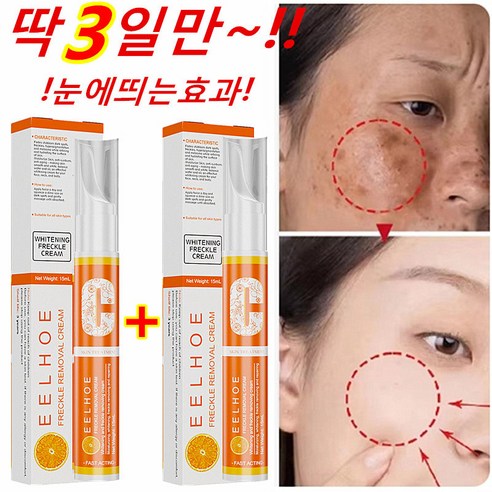 KORE LAN 1+1 기미 잡티 크림 얼굴 색소침착 개선 흑자 제거 피부 화이트닝 에센스 톤업 미백, 15ml * 2, 2개, 15ml