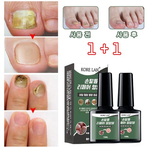 (국내산/당일발송) EELHOE 네일 발톱 영양제 관리 앰플 내성 곰팡이 살균, 4개, 20ml