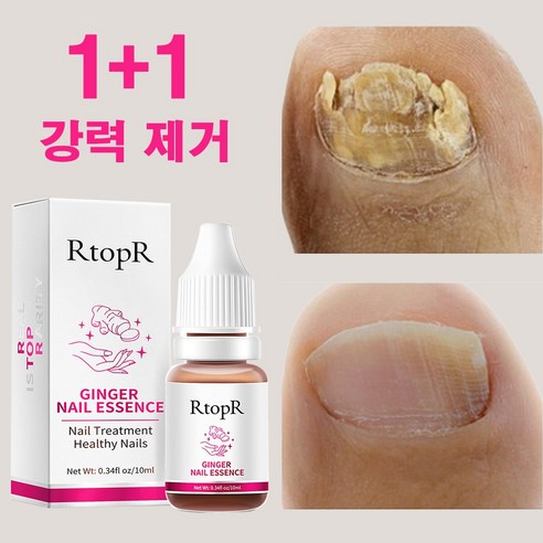 유오노미 독일 1+1 손발톱 발톱 관리 네일, 2개, 10ml