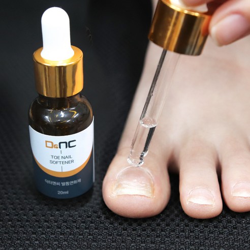두꺼운 발톱을 부드럽게 하는 혁신적인 발톱연화제