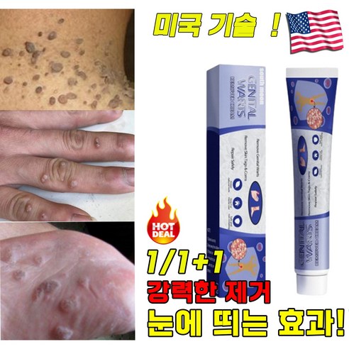 [국내배송]1/1+1미국기술 손 발 피부 치료 제거 연고 효과적인 초본 스킨, 5개, 20g