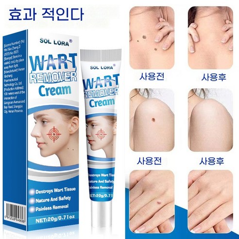 [국내배송] 피부 제거 연고 제거제 기미 점빼기 치료 크림 손 목 얼굴 깨끗함 포장증정, 1개, 20g