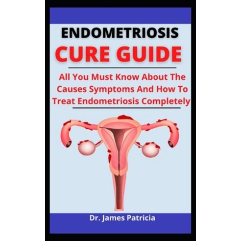 (영문도서) Endometriosis Cure Guide: All You Must Know About The Causes Symptoms And How To Treat Endom... Paperback, Independently Published, English, 9798527169706