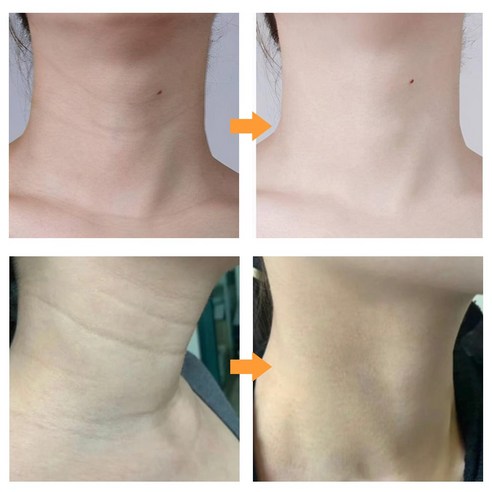 터메릭 넥 크림으로 숨겨진 1cm를 찾아 빛나는 자신감을!