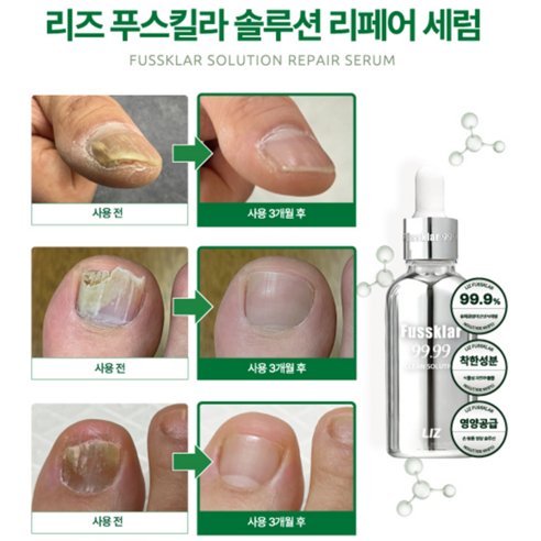 리즈 푸스킬라 30ml 손발톱 영양제 전문 리페어 세럼 강화제, 푸스킬라 솔루션 리페어 세럼, 2개