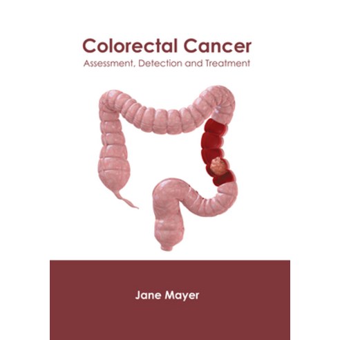 Colorectal Cancer: Assessment Detection and Treatment Hardcover, Foster Academics