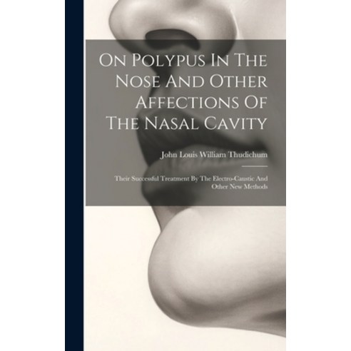 (영문도서) On Polypus In The Nose And Other Affections Of The Nasal Cavity: Their Successful Treatment B... Hardcover, Legare Street Press, English, 9781020989025