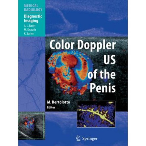 Color Doppler Us of the Penis Paperback, Springer
